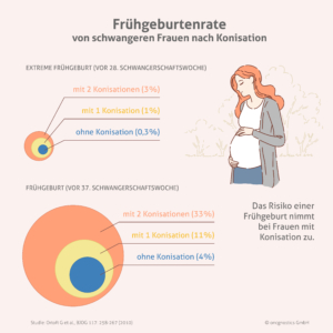 Frühgeburtenrate nach Konisation