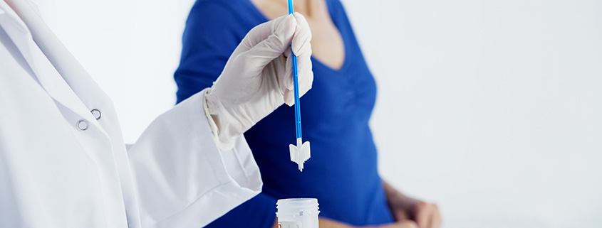 Bürstchen für Pap-Abstrich in der Gebärmutterhalskrebsvorsorge